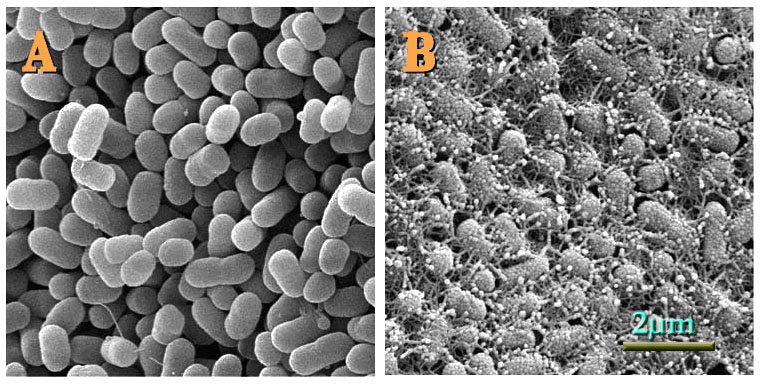 E. Coli;